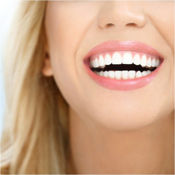 diseno de sonrisa2