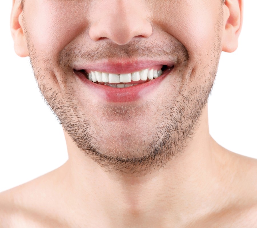 asimetrias faciales
